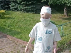 9-летнему мальчику, лицо которого съели собаки в Сочи, восстановили нос