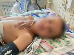 Тяжелораненого 10-летнего ребенка спасли после четырехкратной остановки сердца в Сочи