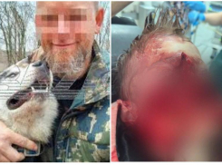 Тюрьма не грозит владельцу собак, разорвавшим лицо мальчику в Сочи