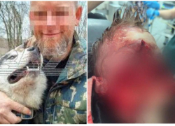 В суде Сочи вынесли приговор владельцу хаски, откусившим лицо 9-летнему мальчику