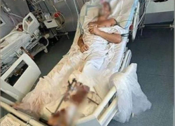 Голый торс стал причиной огнестрельного ранения туриста в Абхазии
