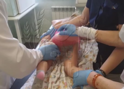 Термический ожог нанесли ребенку в детсаду Сочи