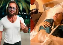 Житель Сочи, выбивший бывшей глаз гаечным ключом, считал ее своей собакой
