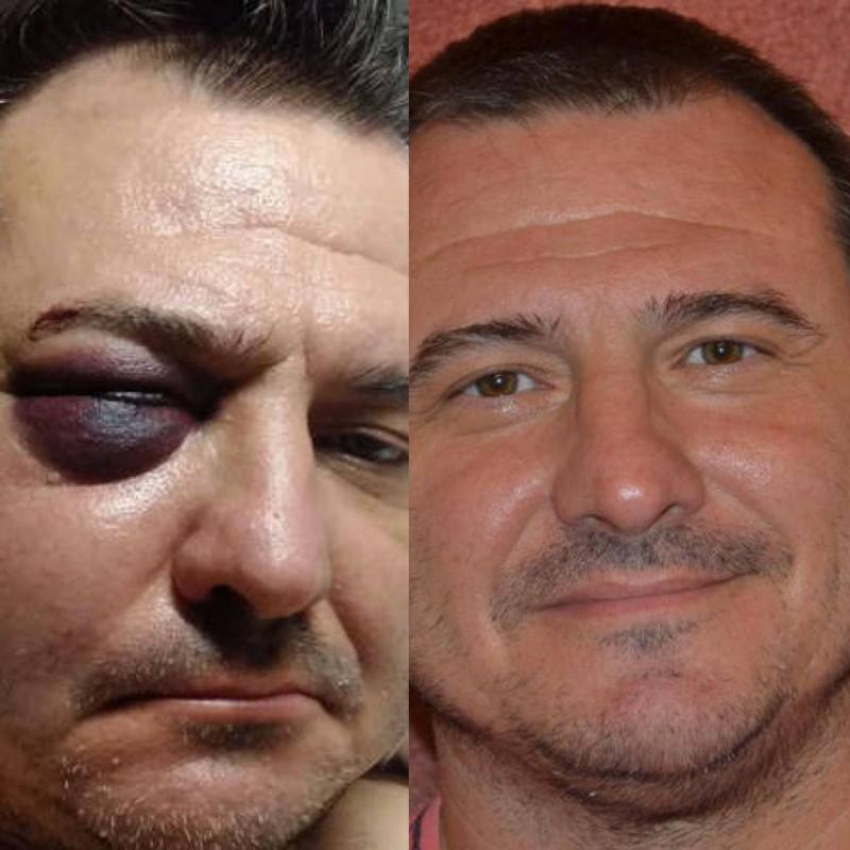 В Сочи жестоко избили бывшего солиста группы «Лесоповал» Руслана Казанцева 