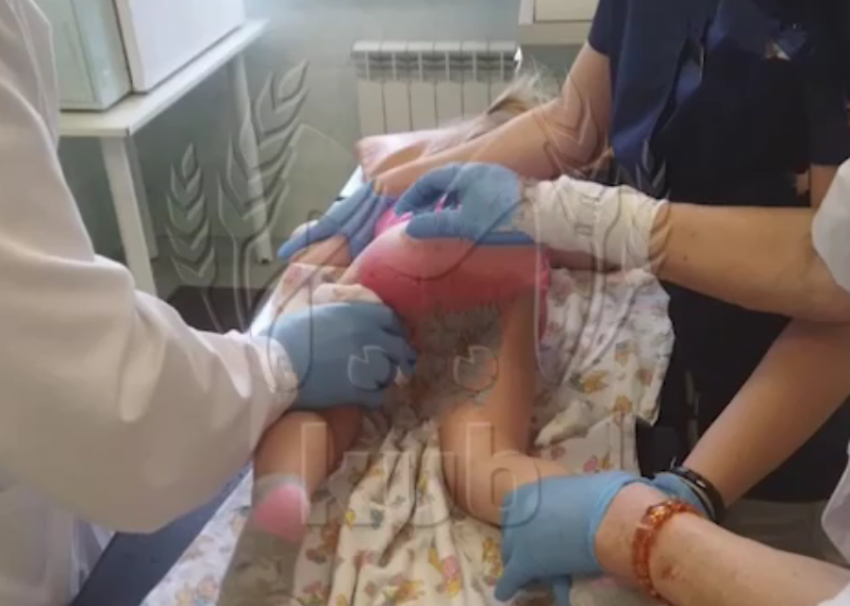 Термический ожог нанесли ребенку в детсаду Сочи